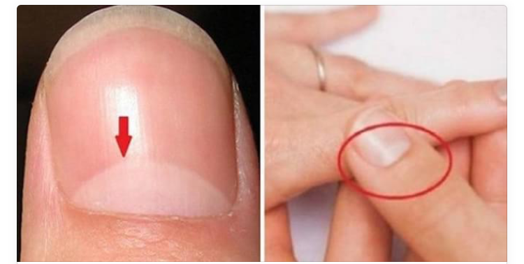 Do You Know What the Semicircle on Your Nails Indicates